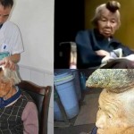 El-caso-de-la-“mujer-unicorno”.-Médicos-muy-sorprendidos