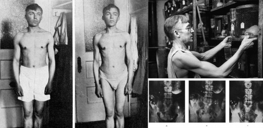 Frederick Hoelzel, el científico que comía cristal, oro, hierro...