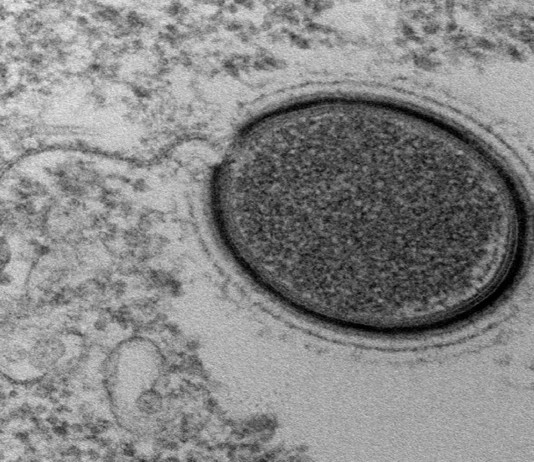 Un nuevo virus gigante aparece en Siberia: ¡Y es el cuarto!