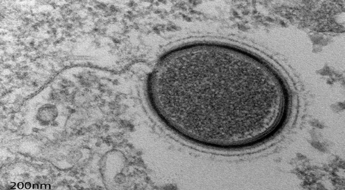 Un nuevo virus gigante aparece en Siberia: ¡Y es el cuarto!