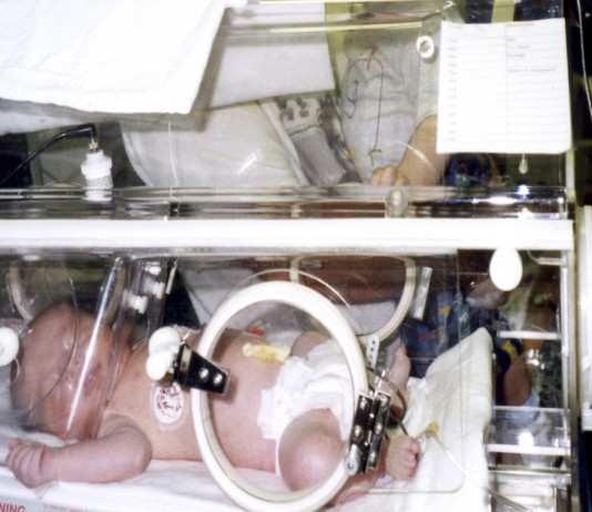 Una nueva placenta artificial para los bebés prematuros