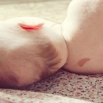 Y tú… ¿Tienes marcas de nacimiento? ¿A qué pueden deberse?