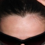 Pico de Viuda en el cabello Supercurioso