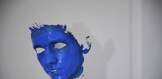 Argiria, una enfermedad muy rara que te vuelve AZUL
