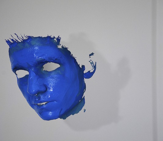 Argiria, una enfermedad muy rara que te vuelve AZUL