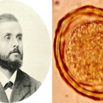 El científico que se tragó huevos de lombriz