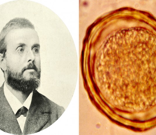 El científico que se tragó huevos de lombriz