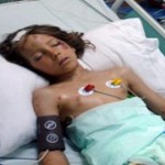 Casos asombrosos: únicos supervivientes de accidentes aéreos