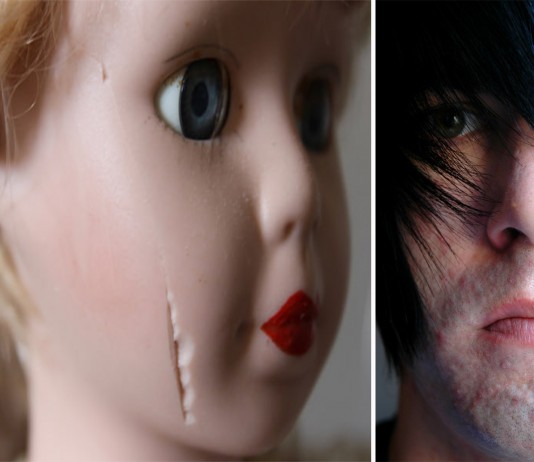 ¿Por qué tenemos cicatrices?