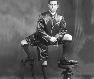 Francesco Lentini, el hombre con tres piernas... Y dos genitales