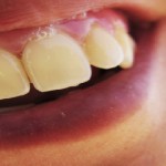 dientes y saliva