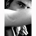 en el brazo