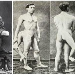 Francesco Lentini, el hombre con tres piernas… Y dos genitales