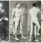 Francesco Lentini, el hombre con tres piernas… Y dos genitales