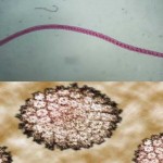 ¡Inaudito! ¿Pueden las lombrices transmitir el cáncer?