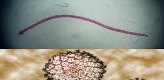 ¡Inaudito! ¿Pueden las lombrices transmitir el cáncer? ¡Inaudito! ¿Pueden las lombrices transmitir el cáncer?