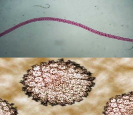 ¡Inaudito! ¿Pueden las lombrices transmitir el cáncer?