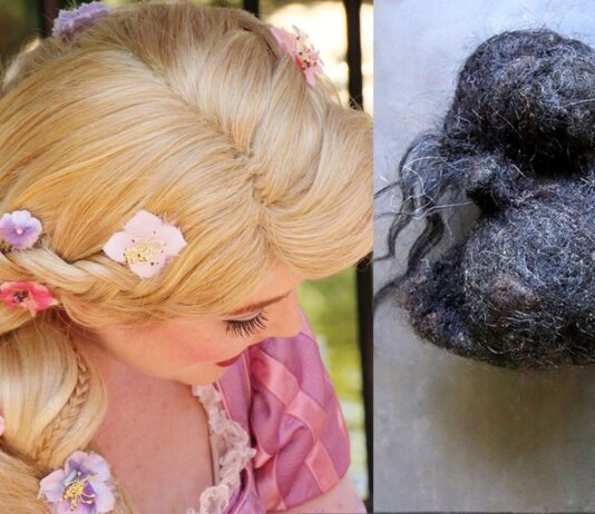 ¿Qué es el Síndrome de Rapunzel? | Un extraño trastorno de cuento que es el sindrome de rapunzel