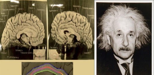¿Puede el cerebro de Einstein explicar su genialidad?