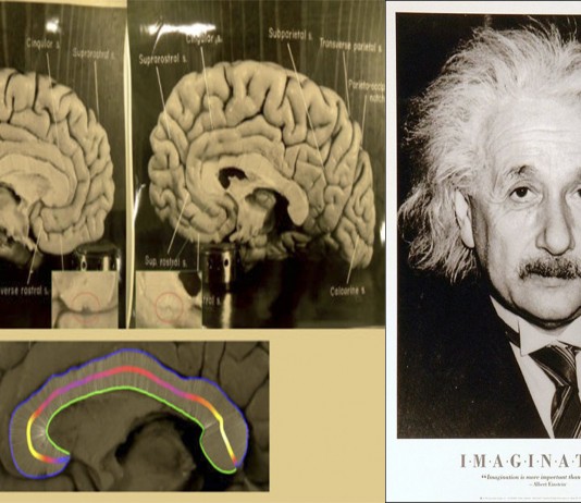 ¿Puede el cerebro de Einstein explicar su genialidad?