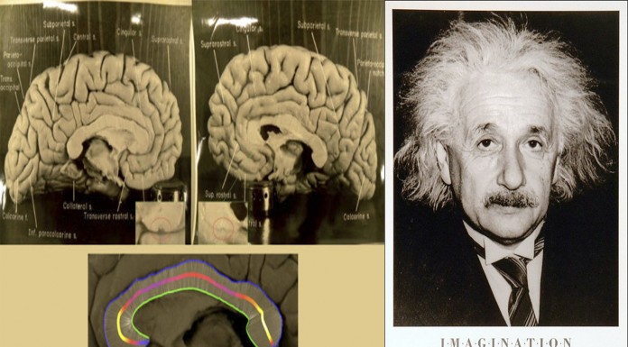 ¿Puede el cerebro de Einstein explicar su genialidad?