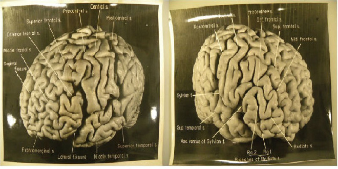 fotos cerebro