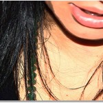 labio inferior grueso