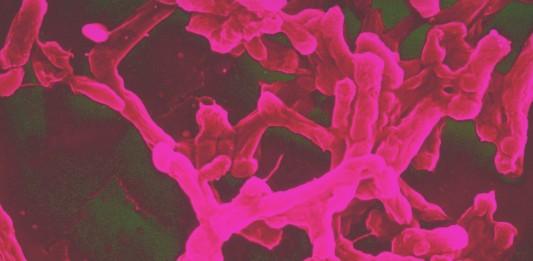 La superbacteria que se propaga por el mundo sin control superbacteria