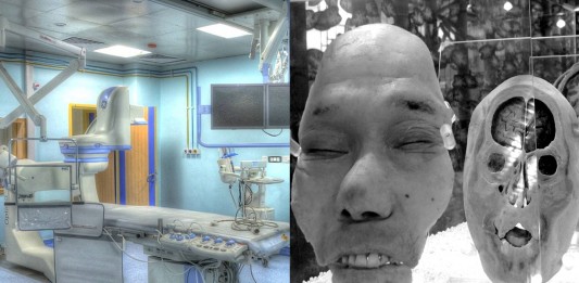Del trasplante de cabeza a la ¡INMORTALIDAD!