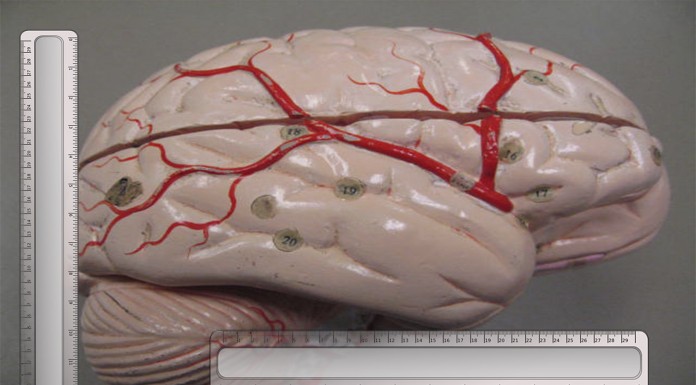 ¿El tamaño de tu cerebro determina tu inteligencia?