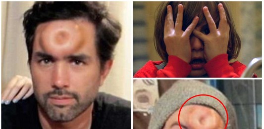 La IMPACTANTE moda del Bagel Head La IMPACTANTE moda del Bagel Head