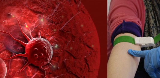 Detectar el cáncer con una muestra de sangre y en 3 minutos ahora es posible Detectar el cáncer con una muestra de sangre y en 3 minutos ahora es posible