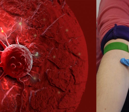 Detectar el cáncer con una muestra de sangre y en 3 minutos ahora es posible Detectar el cáncer con una muestra de sangre y en 3 minutos ahora es posible