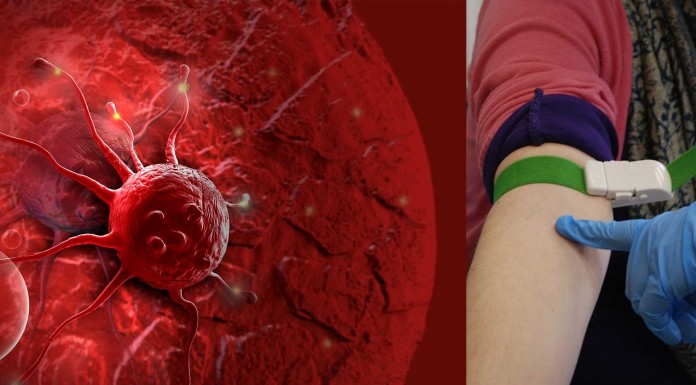 Detectar el cáncer con una muestra de sangre y en 3 minutos ahora es posible