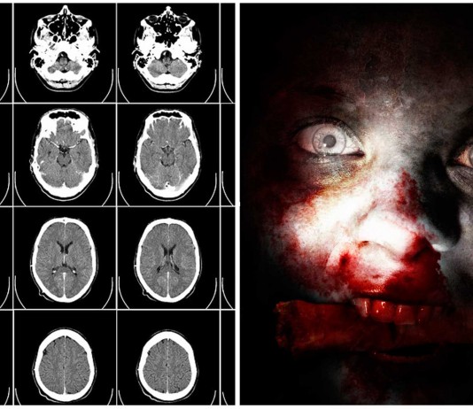 ¡Increíble! ¡Esto hace que tus neuronas cerebrales se vuelvan CANÍBALES!
