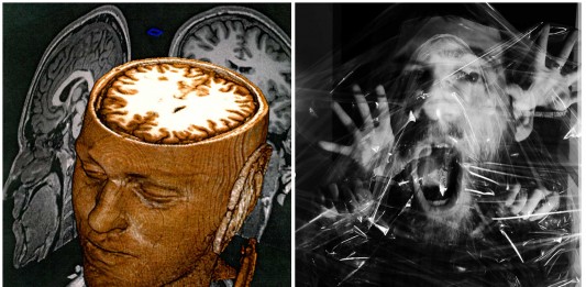 ¿Las personas más inteligentes tienen MÁS riesgos de sufrir esquizofrenia? ¿Las personas más inteligentes tienen MÁS riesgos de sufrir esquizofrenia?