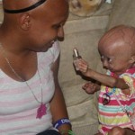 Adalia Ross, niña con progeria
