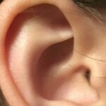 Tubérculo de Darwin. Supercurioso