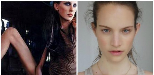 Aterrador, el testimonio de una top model: "Cuánto más peso perdía más trabajo tenía"