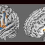cerebro tartamudez