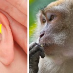 oreja tuberculo de Darwin