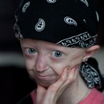 Progeria, la triste enfermedad que convierte a los niños en ancianos