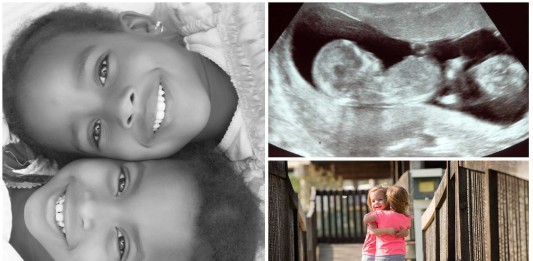 10 curiosidades sobre los gemelos