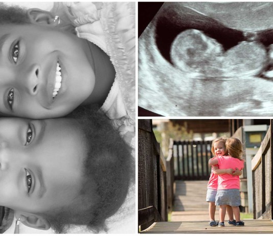 10 curiosidades sobre los gemelos