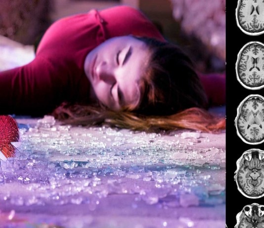 ¡COMPROBADO! Un rechazo amoroso duele físicamente