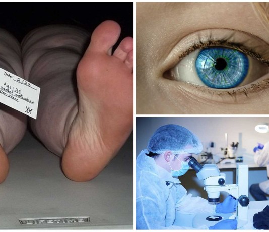 ¿Se puede saber la edad en los ojos de un cadáver?