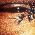 Las 7 enfermedades más antiguas conocidas