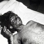 Las 7 enfermedades más antiguas conocidas