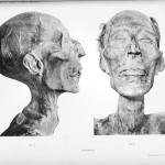 enfermedades más antiguas de la historia