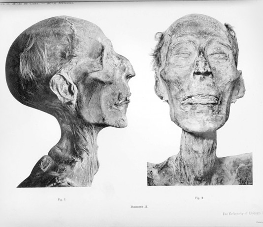 enfermedades más antiguas de la historia